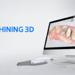 ⚠️ Shining 3D Dental